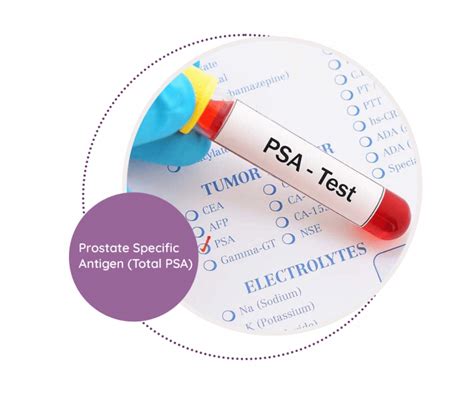 brimps psa|Prostate Specific Antigen (PSA) Test .